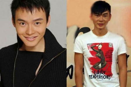 中国整容失败的明星 整容失败的明星曝光!提醒